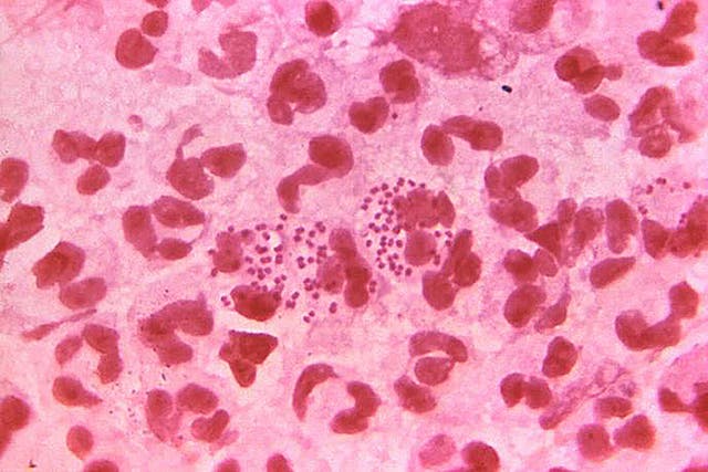 <p>There has been a record rise in gonorrhoea cases in the UK</p>