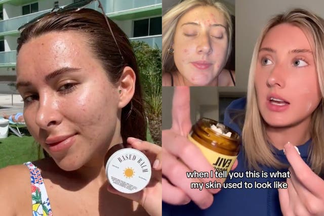 <p>Scientists are skeptical about TikTok’s newest skincare trend involving beef tallow </p>