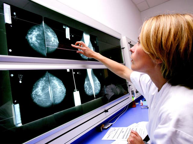 <p>Some patients treated with Enhertu saw their tumours disappear to the point where there was no cancer visible on scans</p>